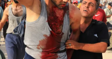Israel continues deadly attacks on Gaza aid sites as 17,000 Palestinian children suffer malnutrition